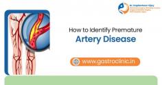 Premature artery disease, also known as early onset arterial disease, can be challenging to detect without proper awareness. Dr. Kapileshwer Vijay recommends paying attention to warning signs such as chest pain, shortness of breath, and fatigue, even in younger individuals. Other indicators include high blood pressure, elevated cholesterol, and a family history of heart disease. Diagnostic tools like blood tests, ultrasounds, and angiograms can confirm early artery damage. Dr. Kapileshwer Vijay emphasizes the importance of a healthy lifestyle, including regular exercise and a balanced diet, to prevent and manage premature artery disease. Early detection is crucial for effective treatment. Read more -  https://www.gastroclinic.in/health-tips/how-to-identify-premature-artery-disease/ 